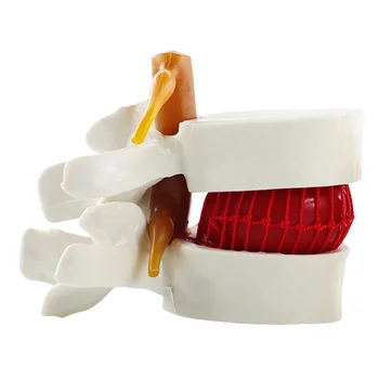 Medvretenčne plošče Model, Manekenka Ledvene Hrbtenice za Dokazovanje Človeško Telo Poučevanja Pvc